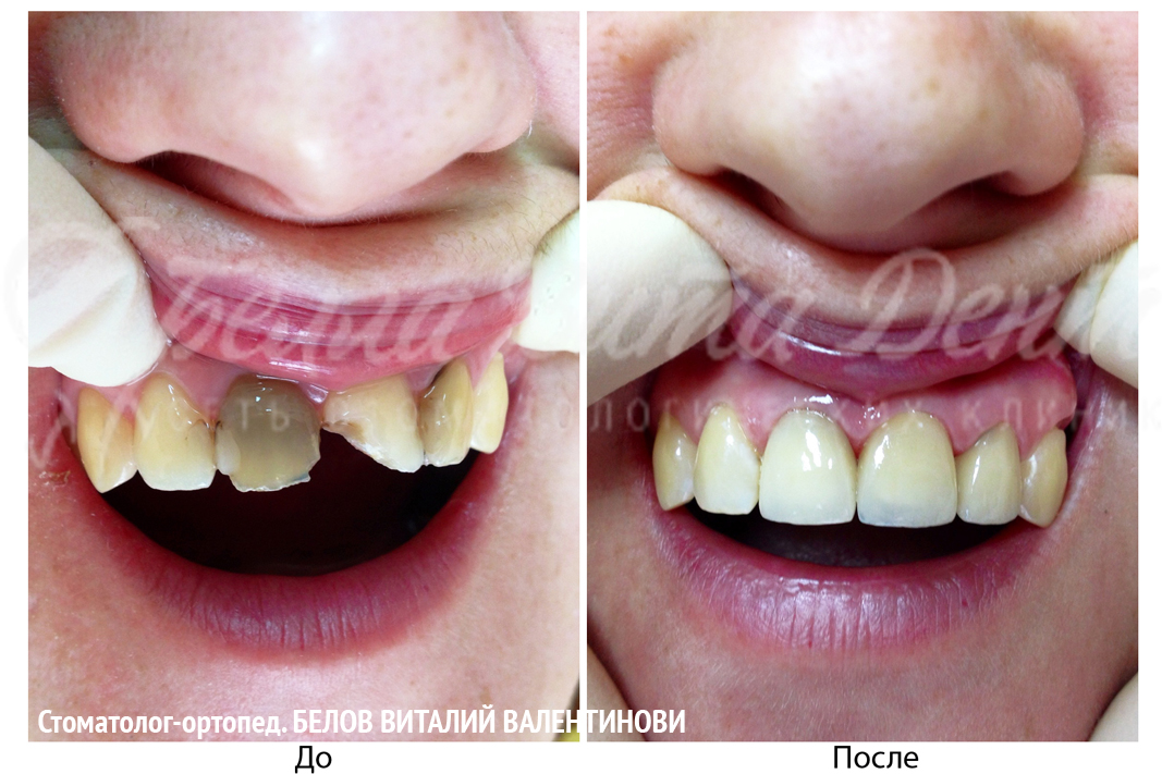 восстановление вкладками /